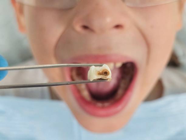 Best Emergency Dentist for Special Needs Patients in Sweeny, TX
